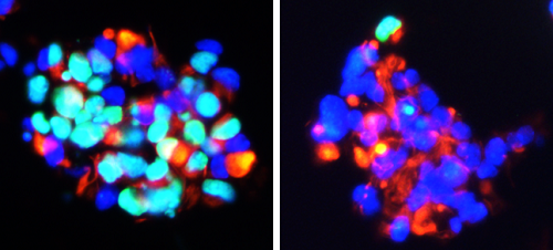 Reduction in EdU labelled proliferating cells (green) in corticosteroid treated neurospheres versus vehicle treated control spheres (left). Nestin (red) and DAPI (blue), photo Rawaa Saleem Al Mayyahi
